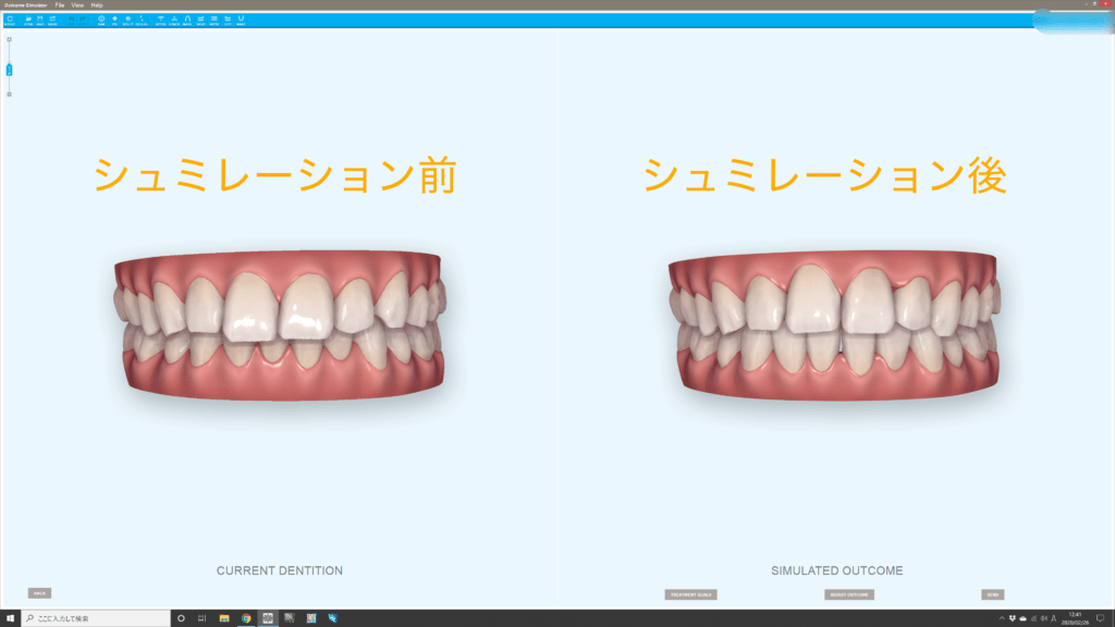 歯科矯正学における3D診断および治療計画 | 三林 栄吾, 深澤 真一, 友成 博, 根岸 慎一, Jean-Marc Retrouvey,  Mohamed-Nur Abdallah, 三林 栄吾, 深澤 真一, 友成 博, 根岸 慎一 |本 | 通販 | Amazon