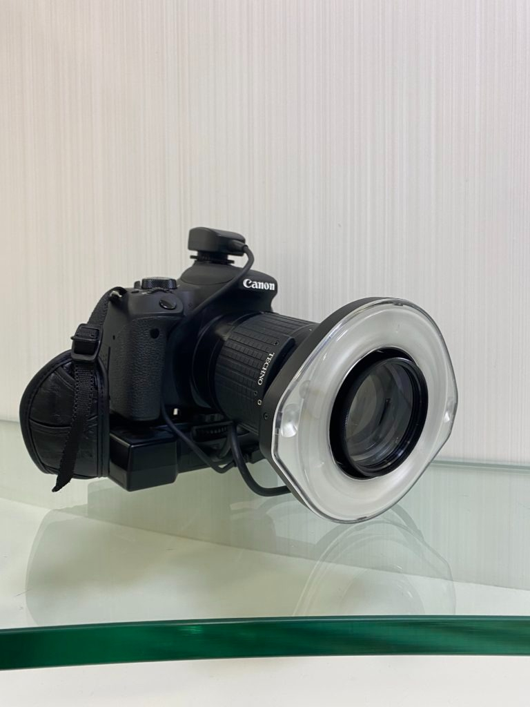 新品矯正口内に写真を撮るの時用 精密検査時の口腔内写真撮影について | マウスピース矯正なら
