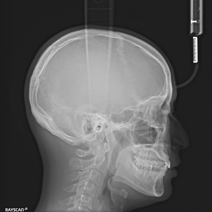 頭部X線規格写真法の基礎