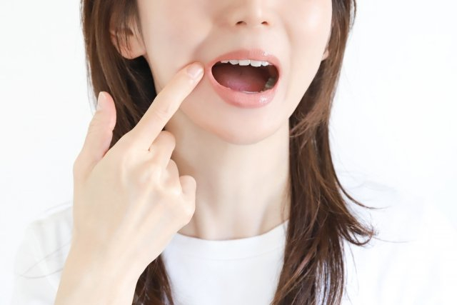 口を開けて口角を指さす女性